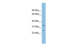 Anti-MSRA antibody, Internal used in Western Blot (WB). GTX45036