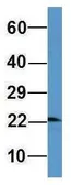 Anti-OMP antibody, Internal used in Western Blot (WB). GTX45044