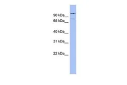 Anti-PNN antibody, Internal used in Western Blot (WB). GTX45055