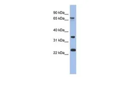 Anti-TBC1D25 antibody, N-term used in Western Blot (WB). GTX45062