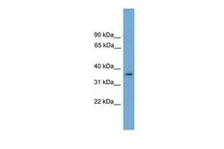 Anti-NUBP1 antibody, N-term used in Western Blot (WB). GTX45063