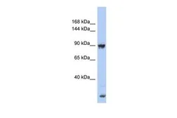 Anti-URG4 antibody, Internal used in Western Blot (WB). GTX45073