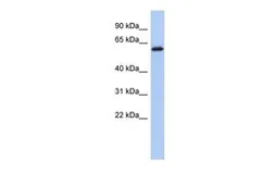 Anti-KLHL7 antibody, Internal used in Western Blot (WB). GTX45084