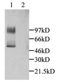 Anti-CX3CL1 antibody used in Western Blot (WB). GTX45088