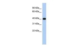 Anti-ERMN antibody, Internal used in Western Blot (WB). GTX45096