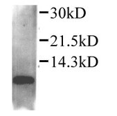 Anti-MIP1 beta antibody used in Western Blot (WB). GTX45129