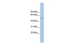 Anti-ANKRD13D antibody, Internal used in Western Blot (WB). GTX45138