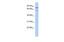 Anti-OSGIN1 antibody, N-term used in Western Blot (WB). GTX45178