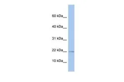 Anti-MPV17L antibody, N-term used in Western Blot (WB). GTX45220