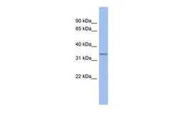 Anti-C17ORF78 antibody, Internal used in Western Blot (WB). GTX45227