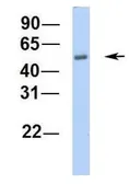 Anti-C16orf73 antibody, Internal used in Western Blot (WB). GTX45259