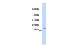 Anti-AAMDC antibody, Internal used in Western Blot (WB). GTX45288