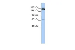 Anti-KIAA0460 antibody, Internal used in Western Blot (WB). GTX45320