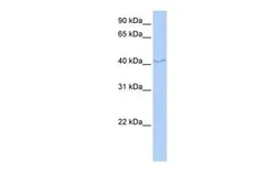 Anti-FAM50B antibody, N-term used in Western Blot (WB). GTX45368