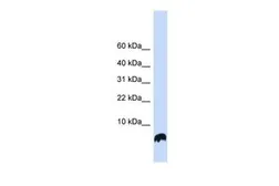 Anti-Glutaredoxin 1 antibody, N-term used in Western Blot (WB). GTX45389