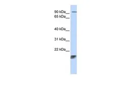 Anti-ICT1 antibody, Internal used in Western Blot (WB). GTX45391