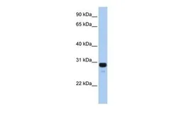 Anti-AMN1 antibody, N-term used in Western Blot (WB). GTX45392
