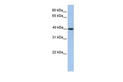 Anti-PELI3 antibody, N-term used in Western Blot (WB). GTX45398