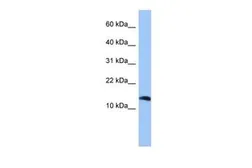 Anti-PTH2 antibody, Internal used in Western Blot (WB). GTX45547