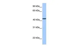 Anti-KLC3 antibody, Internal used in Western Blot (WB). GTX45552