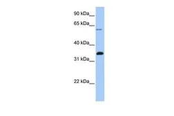 Anti-FBXO16 antibody, C-term used in Western Blot (WB). GTX45585