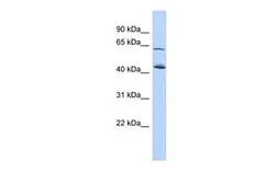 Anti-C5orf33 antibody, Internal used in Western Blot (WB). GTX45619