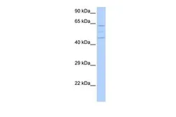 Anti-VPS37A antibody, N-term used in Western Blot (WB). GTX45659