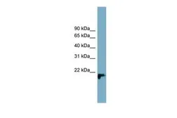 Anti-C1orf93 antibody, Internal used in Western Blot (WB). GTX45666