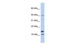 Anti-WFDC5 antibody, N-term used in Western Blot (WB). GTX45684
