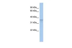 Anti-UBLCP1 antibody, N-term used in Western Blot (WB). GTX45699