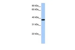 Anti-ACTRT2 antibody, C-term used in Western Blot (WB). GTX45770