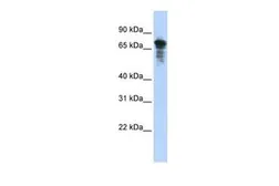 Anti-RHPN1 antibody, Internal used in Western Blot (WB). GTX45779