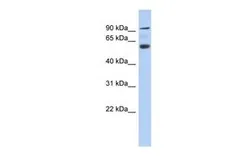 Anti-ACAP3 antibody, N-term used in Western Blot (WB). GTX45785