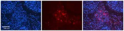 Anti-Arp3 antibody, N-term used in IHC (Paraffin sections) (IHC-P). GTX45806