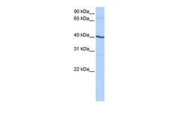 Anti-Casein Kinase 1 gamma 2 antibody, N-term used in Western Blot (WB). GTX45816