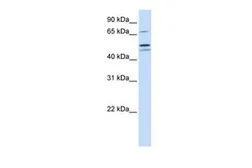 Anti-EARS2 antibody, Internal used in Western Blot (WB). GTX45829