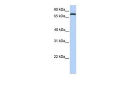 Anti-COLEC12 antibody, Internal used in Western Blot (WB). GTX45877