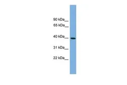 Anti-ITLN2 antibody, Internal used in Western Blot (WB). GTX45879