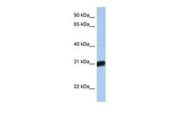 Anti-B3GALT6 antibody, C-term used in Western Blot (WB). GTX45882