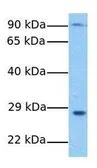 Anti-SURF4 antibody, N-term used in Western Blot (WB). GTX45909
