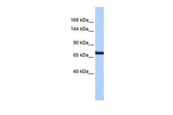 Anti-PCDH15 antibody, N-term used in Western Blot (WB). GTX45912