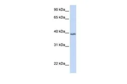 Anti-TSPAN10 antibody, N-term used in Western Blot (WB). GTX45936