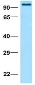 Anti-SUN1 antibody, N-term used in Western Blot (WB). GTX45959