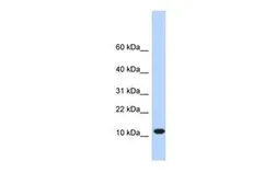 Anti-C10ORF57 antibody, Internal used in Western Blot (WB). GTX45960