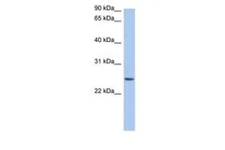Anti-NRSN2 antibody, Internal used in Western Blot (WB). GTX45964