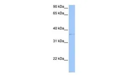 Anti-TREML2 antibody, Internal used in Western Blot (WB). GTX45970