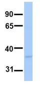 Anti-LPPR2 antibody, Internal used in Western Blot (WB). GTX46008