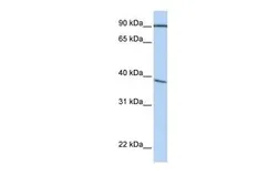 Anti-POPDC3 antibody, C-term used in Western Blot (WB). GTX46017