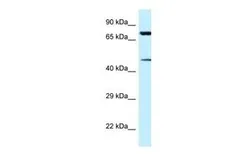 Anti-CDH22 antibody, N-term used in Western Blot (WB). GTX46027