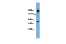 Anti-PCDHB15 antibody, N-term used in Western Blot (WB). GTX46078